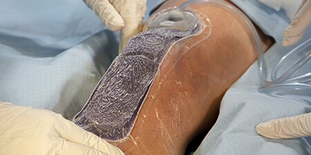 Three surgeons operating on a patient

