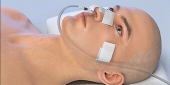 Critical Tube Securement Nasogastric Application video
